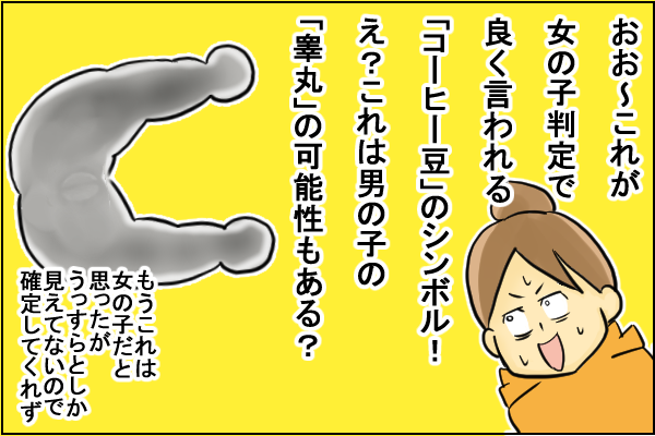 エコー写真の見方|女の子